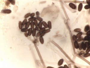 Stachybotrys spores AKA toxic mold or toxic black mold at top of spore producing conodiaphore